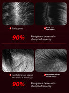 VELYRA™ Red Light Scalp Massage Comb