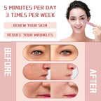 VELYRA™ EMS Microcurrent Face Lifting Device